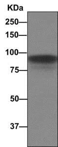 Western blot - Anti-CD105 antibody [EPR10145-12] (AB169545)