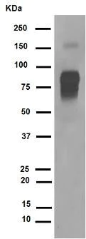 Western blot - Anti-CD105 antibody [EPR10145-12] (AB169545)