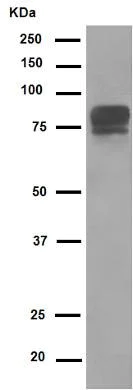 Western blot - Anti-CD105 antibody [EPR10145-12] (AB169545)