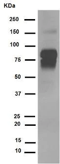 Western blot - Anti-CD105 antibody [EPR10145-12] (AB169545)