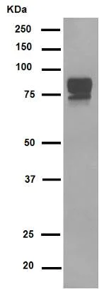 Western blot - Anti-CD105 antibody [EPR10145-12] (AB169545)
