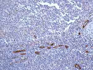 Immunohistochemistry (Formalin/PFA-fixed paraffin-embedded sections) - Anti-CD105 antibody [EPR10145-12] - BSA and Azide free (AB271922)