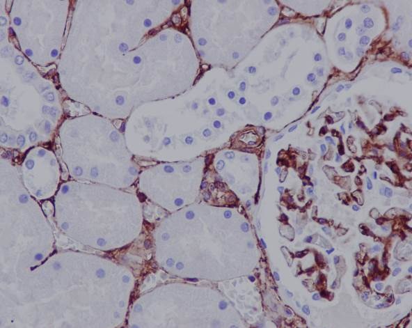 Immunohistochemistry (Formalin/PFA-fixed paraffin-embedded sections) - Anti-CD105 antibody [EPR10145-12] - BSA and Azide free (AB271922), expandable thumbnail