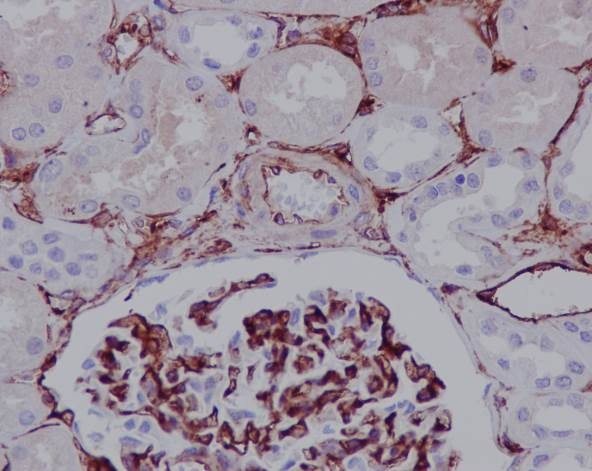 Immunohistochemistry (Formalin/PFA-fixed paraffin-embedded sections) - Anti-CD105 antibody [EPR10145-12] - BSA and Azide free (AB271922), expandable thumbnail