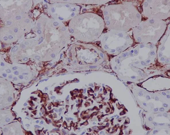 Immunohistochemistry (Formalin/PFA-fixed paraffin-embedded sections) - Anti-CD105 antibody [EPR10145-12] - BSA and Azide free (AB271922)