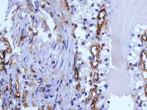 Immunohistochemistry (Formalin/PFA-fixed paraffin-embedded sections) - Anti-CD105 antibody [EPR10145-12] - BSA and Azide free (AB271922), expandable thumbnail