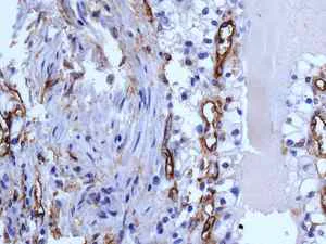 Immunohistochemistry (Formalin/PFA-fixed paraffin-embedded sections) - Anti-CD105 antibody [EPR10145-12] - BSA and Azide free (AB271922)