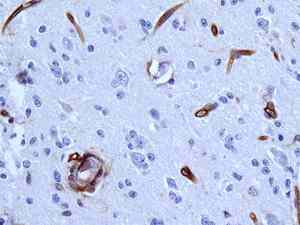 Immunohistochemistry (Formalin/PFA-fixed paraffin-embedded sections) - Anti-CD105 antibody [EPR10145-12] - Low endotoxin, Azide free (AB219362)