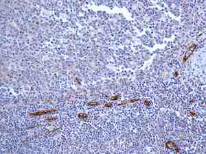 Immunohistochemistry (Formalin/PFA-fixed paraffin-embedded sections) - Anti-CD105 antibody [EPR10145-12] - Low endotoxin, Azide free (AB219362)