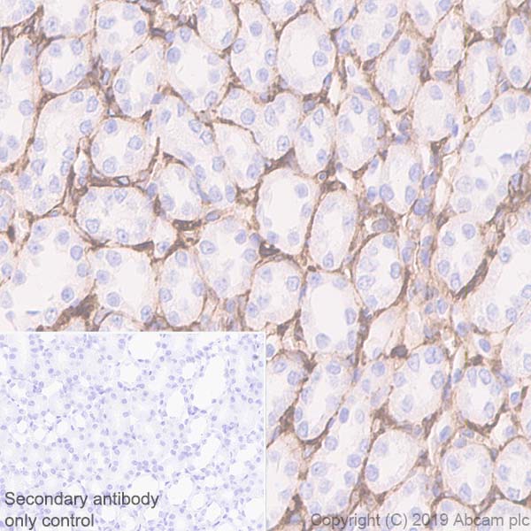 Immunohistochemistry (Formalin/PFA-fixed paraffin-embedded sections) - Anti-CD105 antibody [EPR19911-220] (AB252345), expandable thumbnail