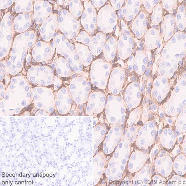 Immunohistochemistry (Formalin/PFA-fixed paraffin-embedded sections) - Anti-CD105 antibody [EPR19911-220] (AB252345)