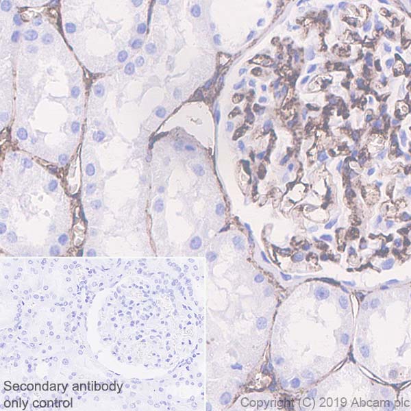 Immunohistochemistry (Formalin/PFA-fixed paraffin-embedded sections) - Anti-CD105 antibody [EPR19911-220] (AB252345), expandable thumbnail