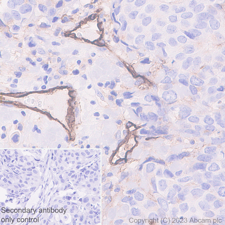 Immunohistochemistry (Formalin/PFA-fixed paraffin-embedded sections) - Anti-CD105 antibody [EPR19911-220] (ab252345), expandable thumbnail