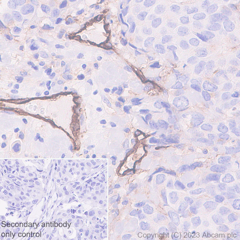 Immunohistochemistry (Formalin/PFA-fixed paraffin-embedded sections) - Anti-CD105 antibody [EPR19911-220] (AB252345)