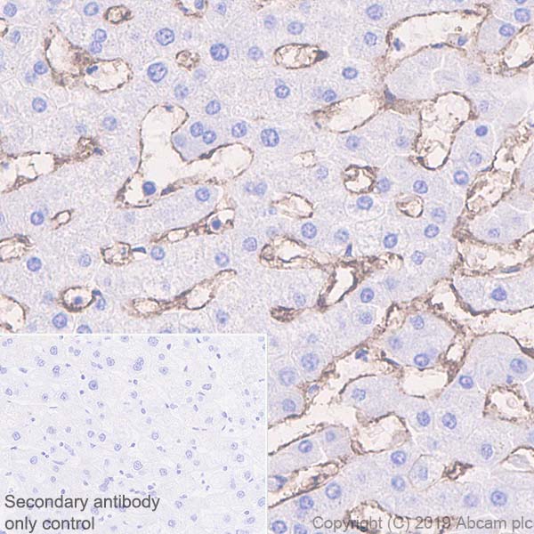 Immunohistochemistry (Formalin/PFA-fixed paraffin-embedded sections) - Anti-CD105 antibody [EPR19911-220] (AB252345), expandable thumbnail
