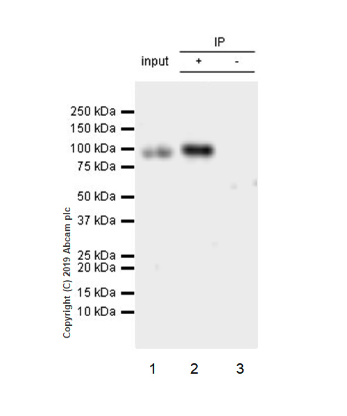 Immunoprecipitation - Anti-CD105 antibody [EPR19911-220] (AB252345), expandable thumbnail