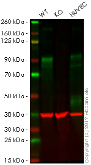 Western blot - Anti-CD105 antibody [EPR19911-220] (AB252345), expandable thumbnail