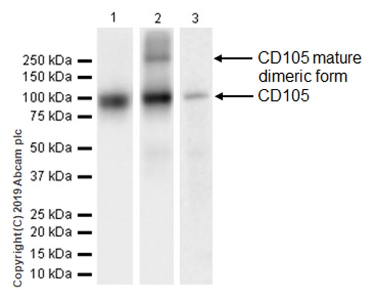 Western blot - Anti-CD105 antibody [EPR19911-220] (ab252345), expandable thumbnail