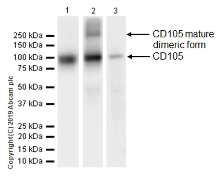 Western blot - Anti-CD105 antibody [EPR19911-220] (AB252345)