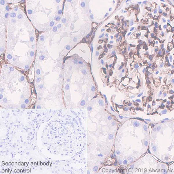 Immunohistochemistry (Formalin/PFA-fixed paraffin-embedded sections) - Anti-CD105 antibody [EPR19911-220] - BSA and Azide free (AB252548)
