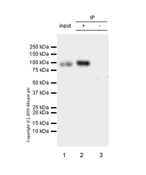 Immunoprecipitation - Anti-CD105 antibody [EPR19911-220] - BSA and Azide free (AB252548)
