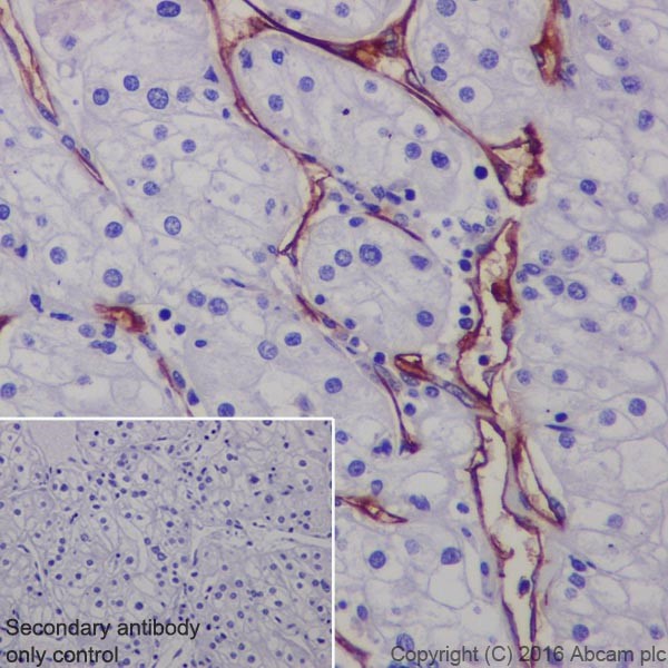 Immunohistochemistry (Formalin/PFA-fixed paraffin-embedded sections) - Anti-CD105 antibody [EPR19911] (AB206419), expandable thumbnail