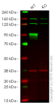 Western blot - Anti-CD105 antibody [EPR19911] (AB206419), expandable thumbnail
