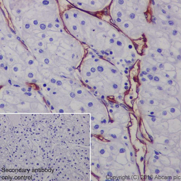 Immunohistochemistry (Formalin/PFA-fixed paraffin-embedded sections) - Anti-CD105 antibody [EPR19911] - BSA and Azide free (AB251457)