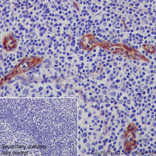 Immunohistochemistry (Formalin/PFA-fixed paraffin-embedded sections) - Anti-CD105 antibody [EPR19911] - BSA and Azide free (AB251457)