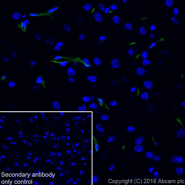 Immunohistochemistry (Formalin/PFA-fixed paraffin-embedded sections) - Anti-CD105 antibody [EPR21846] (ab221675), expandable thumbnail