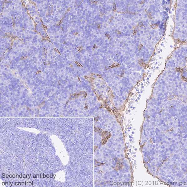 Immunohistochemistry (Formalin/PFA-fixed paraffin-embedded sections) - Anti-CD105 antibody [EPR21846] (AB221675), expandable thumbnail
