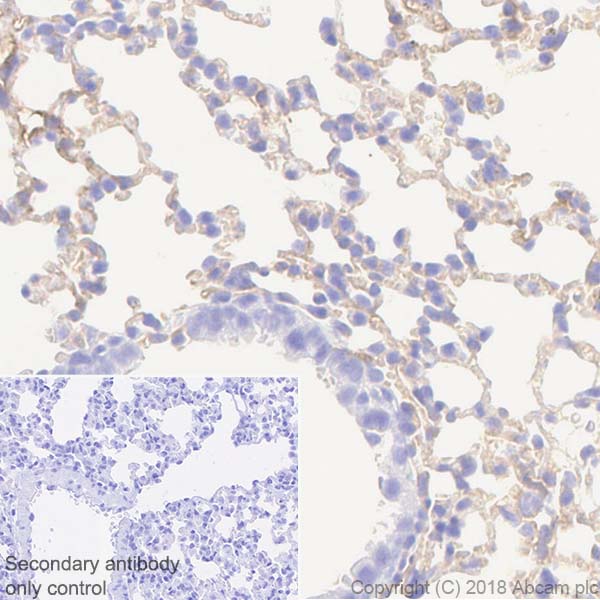 Immunohistochemistry (Formalin/PFA-fixed paraffin-embedded sections) - Anti-CD105 antibody [EPR21846] (AB221675), expandable thumbnail