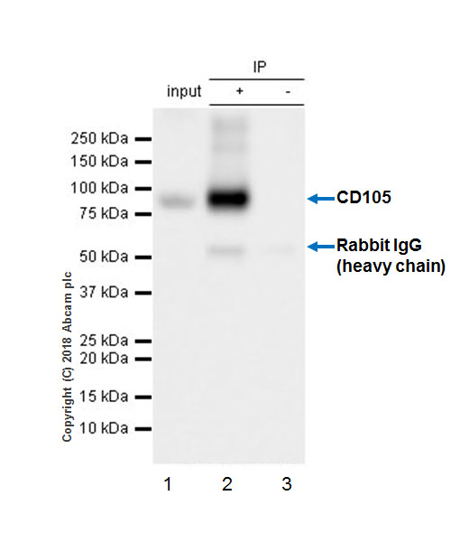 Immunoprecipitation - Anti-CD105 antibody [EPR21846] (ab221675), expandable thumbnail