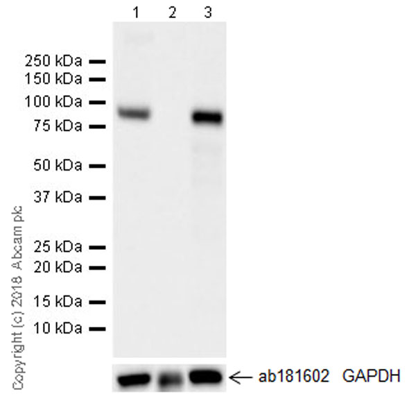 Western blot - Anti-CD105 antibody [EPR21846] (AB221675), expandable thumbnail