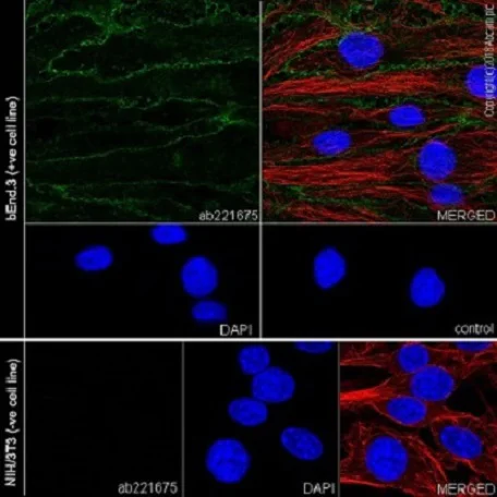 Immunocytochemistry/ Immunofluorescence - Anti-CD105 antibody [EPR21846] - BSA and Azide free (AB231832)