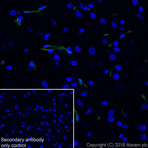 Immunohistochemistry (Formalin/PFA-fixed paraffin-embedded sections) - Anti-CD105 antibody [EPR21846] - BSA and Azide free (AB231832)