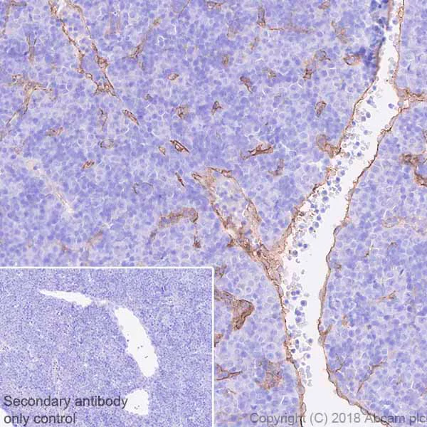 Immunohistochemistry (Formalin/PFA-fixed paraffin-embedded sections) - Anti-CD105 antibody [EPR21846] - BSA and Azide free (AB231832)