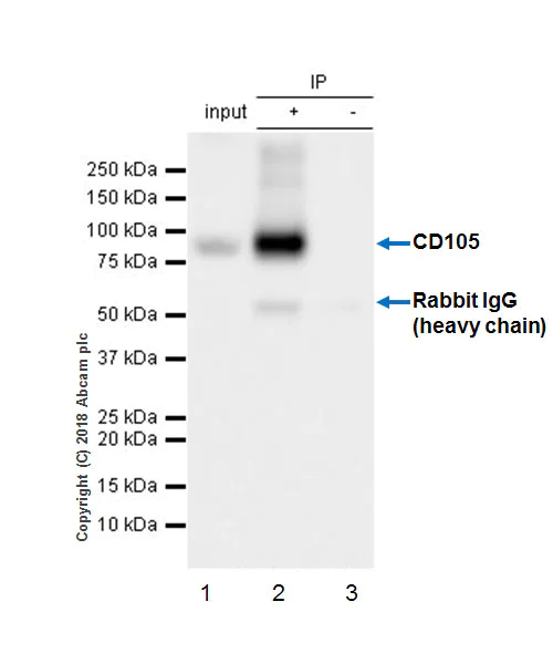 Immunoprecipitation - Anti-CD105 antibody [EPR21846] - BSA and Azide free (AB231832)
