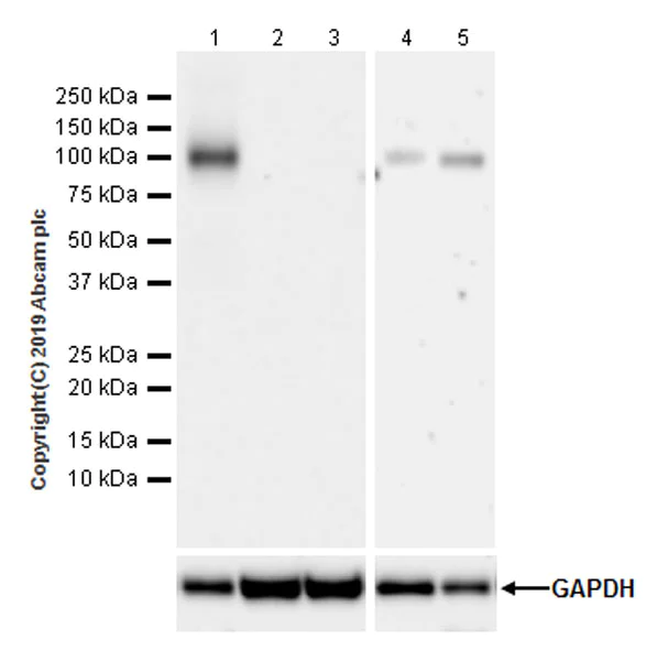 Western blot - Anti-CD105 antibody [EPR22811-18] (AB231774)