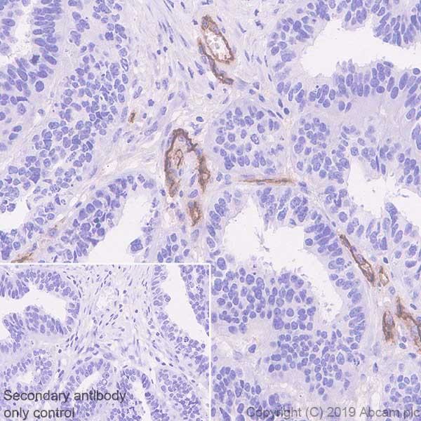 Immunohistochemistry (Formalin/PFA-fixed paraffin-embedded sections) - Anti-CD105 antibody [EPR22811-18] - BSA and Azide free (AB256146), expandable thumbnail
