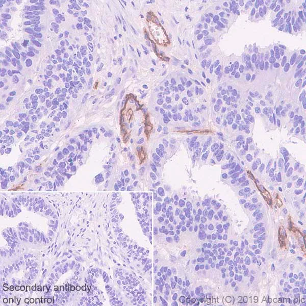 Immunohistochemistry (Formalin/PFA-fixed paraffin-embedded sections) - Anti-CD105 antibody [EPR22811-18] - BSA and Azide free (AB256146)