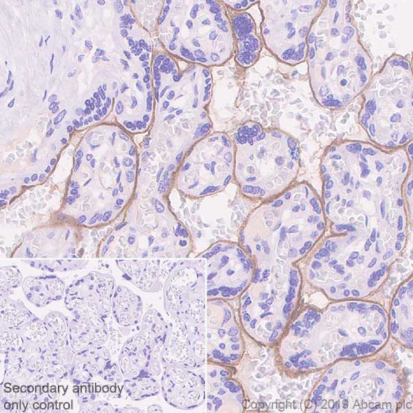 Immunohistochemistry (Formalin/PFA-fixed paraffin-embedded sections) - Anti-CD105 antibody [EPR22811-18] - BSA and Azide free (AB256146), expandable thumbnail