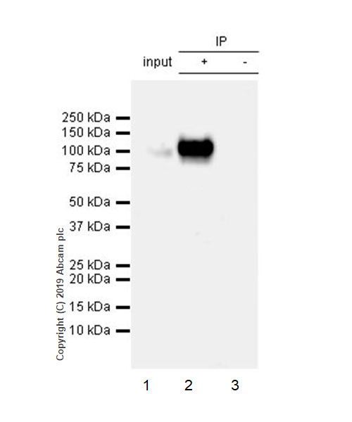 Immunoprecipitation - Anti-CD105 antibody [EPR22811-18] - BSA and Azide free (AB256146), expandable thumbnail