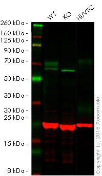 Western blot - Anti-CD105 antibody [MEM-226] (AB2529)