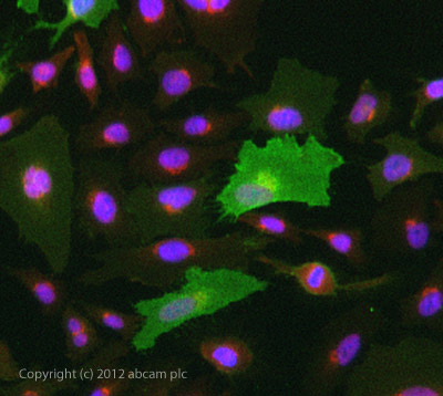 Immunocytochemistry/ Immunofluorescence - Anti-CD105 antibody [MEM-229] (AB69772), expandable thumbnail