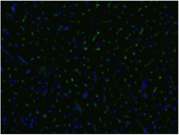 Immunohistochemistry (Frozen sections) - Anti-CD105 antibody [MEM-229] (AB69772), expandable thumbnail