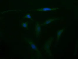 Immunocytochemistry/ Immunofluorescence - Anti-CD105 antibody [OTI8A1] (AB156756)