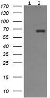 Western blot - Anti-CD105 antibody [OTI8A1] (AB156756)