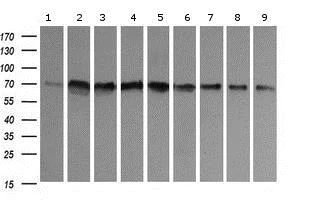 Western blot - Anti-CD105 antibody [OTI8A1] (AB156756)