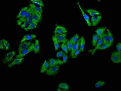 Immunocytochemistry/ Immunofluorescence - Anti-CD109 antibody (AB235896)
